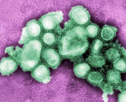 В Запорожье бушует сразу четыре вируса гриппа 
