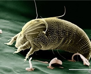 Чесоточный клещ бегает за киевлянами