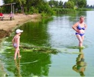 После купания в столичных озерах шестеро киевлян подхватили лептоспироз