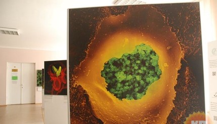 Нано-картины покажут как выглядит наша иммунная система