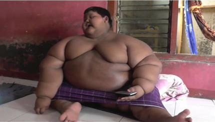 Самый толстый мальчик в мире сел на диету 