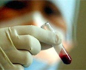 В Днепропетровске всех больных острой кишечной инфекцией будут проверять на холеру