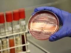 В водопроводе Дании нашли смертельно опасную палочку E.coli