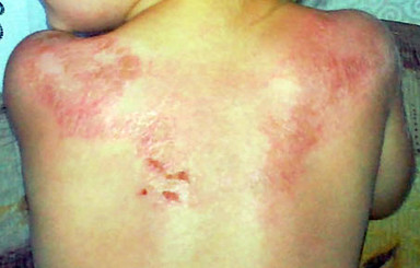 Харьковская психопатка искусала своего 4-летнего сына у супермаркета