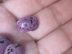 Врачи не смогли спасти годовалую девочку, подавившуюся фасолью