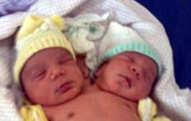 В Бразилии родился двуглавый мальчик