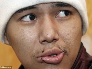 Заключенные в тюрьмах Киргизии зашивают себе рты