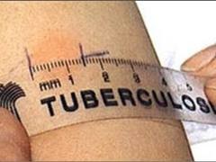 В Украине больных туберкулезом будут лечить принудительно