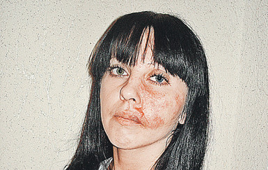 Эта страшная пластика 