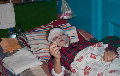 Хулиганы опалили ребенку лицо петардой, а в милиции отмахнулись: пустяки!  