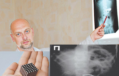 Севастопольские врачи спасли мальчика, проглотившего 30 магнитов 