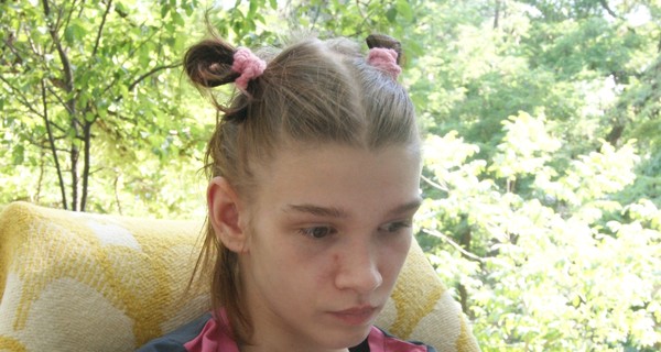 Жертва николаевского садиста Саша Попова уже гуляет на улице