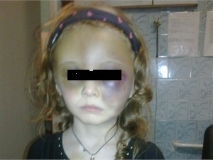 В Донецке психически больная женщина  едва не убила собственную дочь