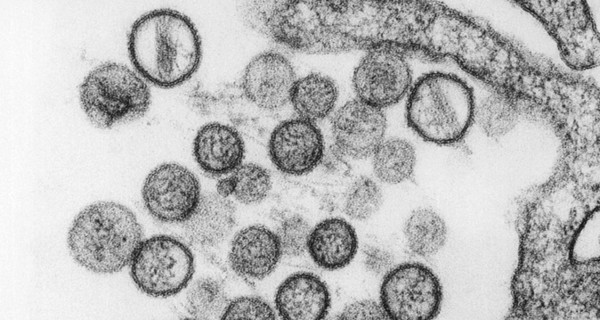 Белоногие хомячки могли заразить хантавирусом 22 тысячи жителей США