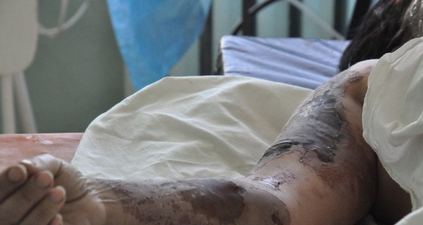 Мужчина, обливший кислотой керчанку, до сих пор на свободе