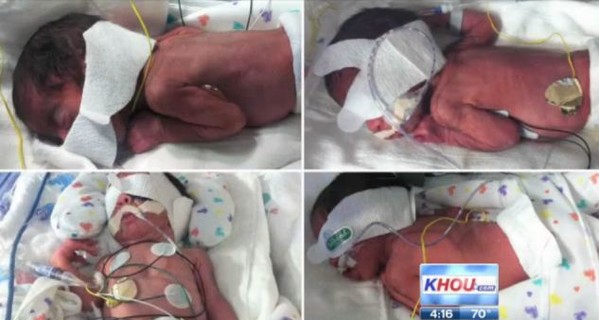 В США пара запланировала братика для сына и 