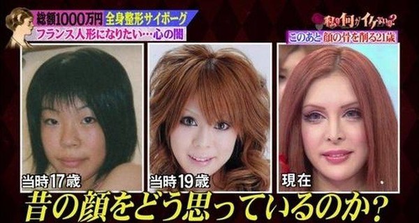 Японка сделала тридцать пластических операций, чтобы получить европейскую внешность