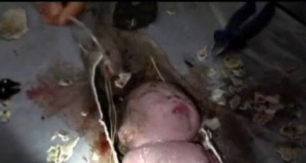 В Китае родители спустили в унитаз новорожденного сына: ребенок чудом выжил