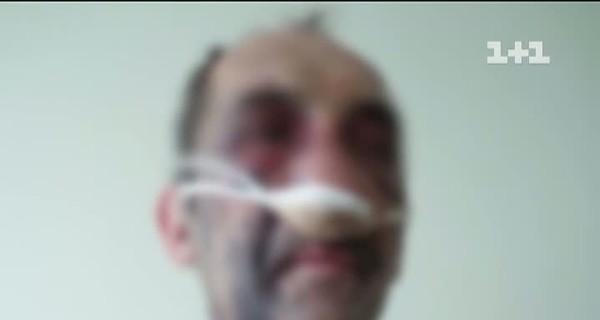 Подробности резонансной драки под Киевом: семье пострадавшего угрожают