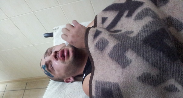 На Донбассе жестоко избили двоих активистов 