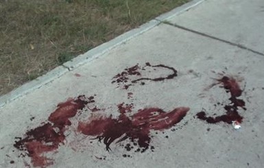 Милиция взялась за избиение журналиста 