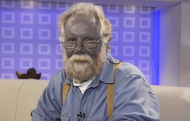 Умер знаменитый синекожий  человек