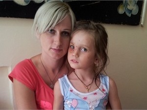 В Донбассе судят владельца питбуля, напавшего на девочку