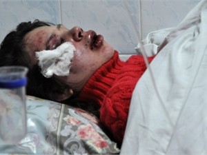 Избитую Татьяну Черновил прооперируют