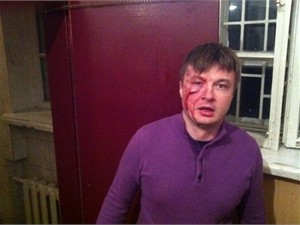 Избитый депутат Ильенко сбежал из больницы домой