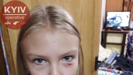 В Киеве пожилая женщина напала на 11-летнюю девочку и ее отца