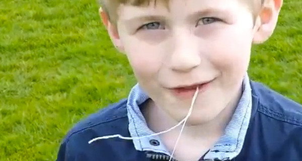 Восьмилетнему мальчику выдернули зуб вертолетом