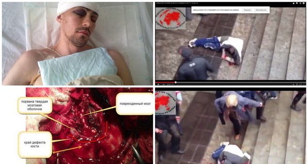 Харьковчанина, которому проломили голову в Вербное воскресенье, отправят на лечение в Австрию