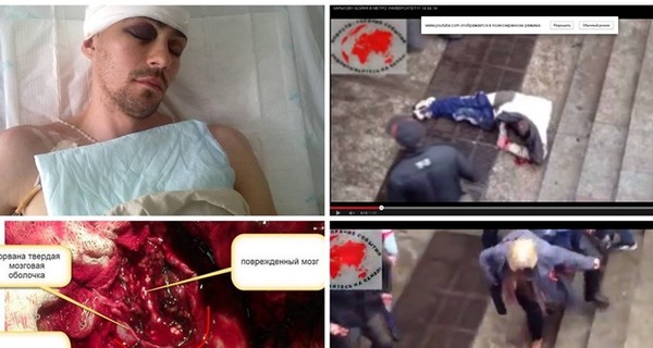 Харьковчанина, которому проломили голову в Вербное воскресенье, отправят на лечение в Австрию