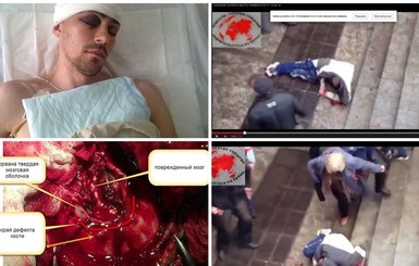 Майдановца, которому в Харькове у метро проломили голову, выписали домой