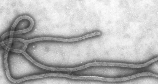 У двух россиян заподозрили лихорадку Эбола