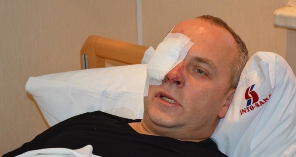 Шуфрич выписался из одесской больницы и вернулся в Киев