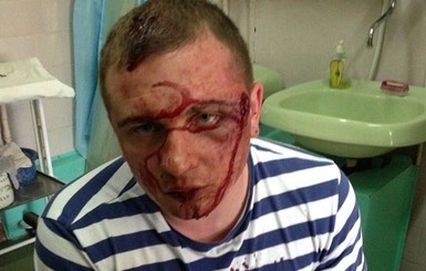 На Киевщине депутату дважды выстрелили в голову в упор