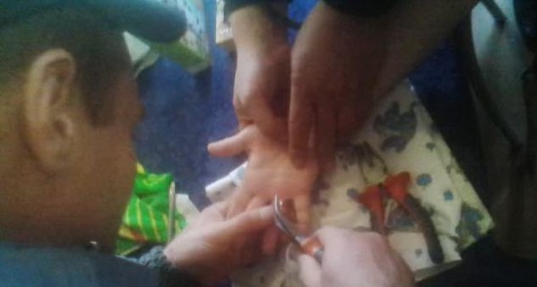 В Киеве женщине помогли снять кольцо с пальца