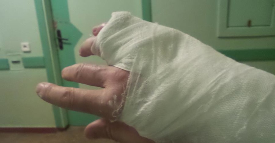 В Чернигове охранники нардепа выбросили журналиста из филармонии, сломав ему палец