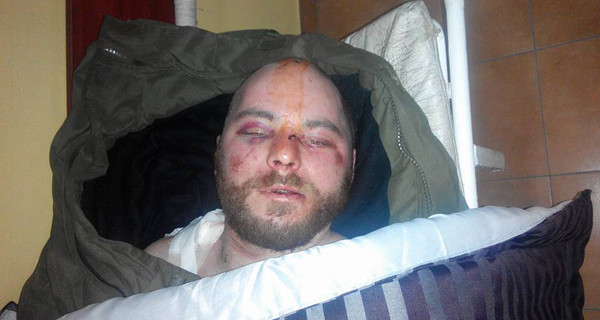 Адвокат показал избитые лица бойцов 