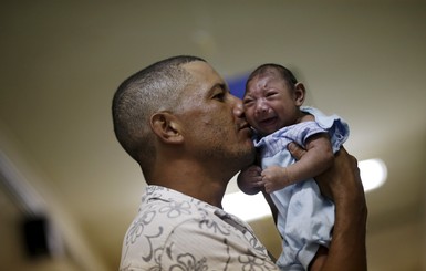 В Бразилии подтвердили более 400 случаев микроцефалии у младенцев