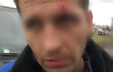 Во Львове водитель автобуса разбил дверью голову мужчине