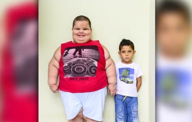 Самый толстый ребенок в мире весит 80 килограммов