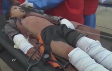 В Йемене авиация нанесла удар по мусульманиський школе, погибли десять детей