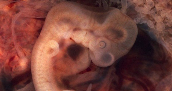 Ученые создали эмбриона-химеру соединив клетки человека и свиньи