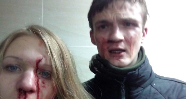 Муж Заверухи заявил, что их избили бывшие побратимы