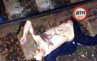 В Киеве мужчине, который перебегал через рельсы, поездом оторвало левую ногу