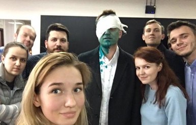 Навальному повредили глаз, облив зеленкой 