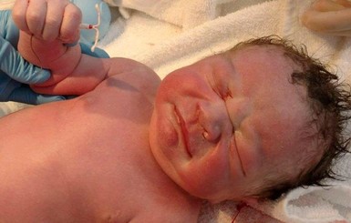 В США родился ребенок с контрацептивом в руке