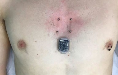 Программист вживил себе в грудь компас-чип